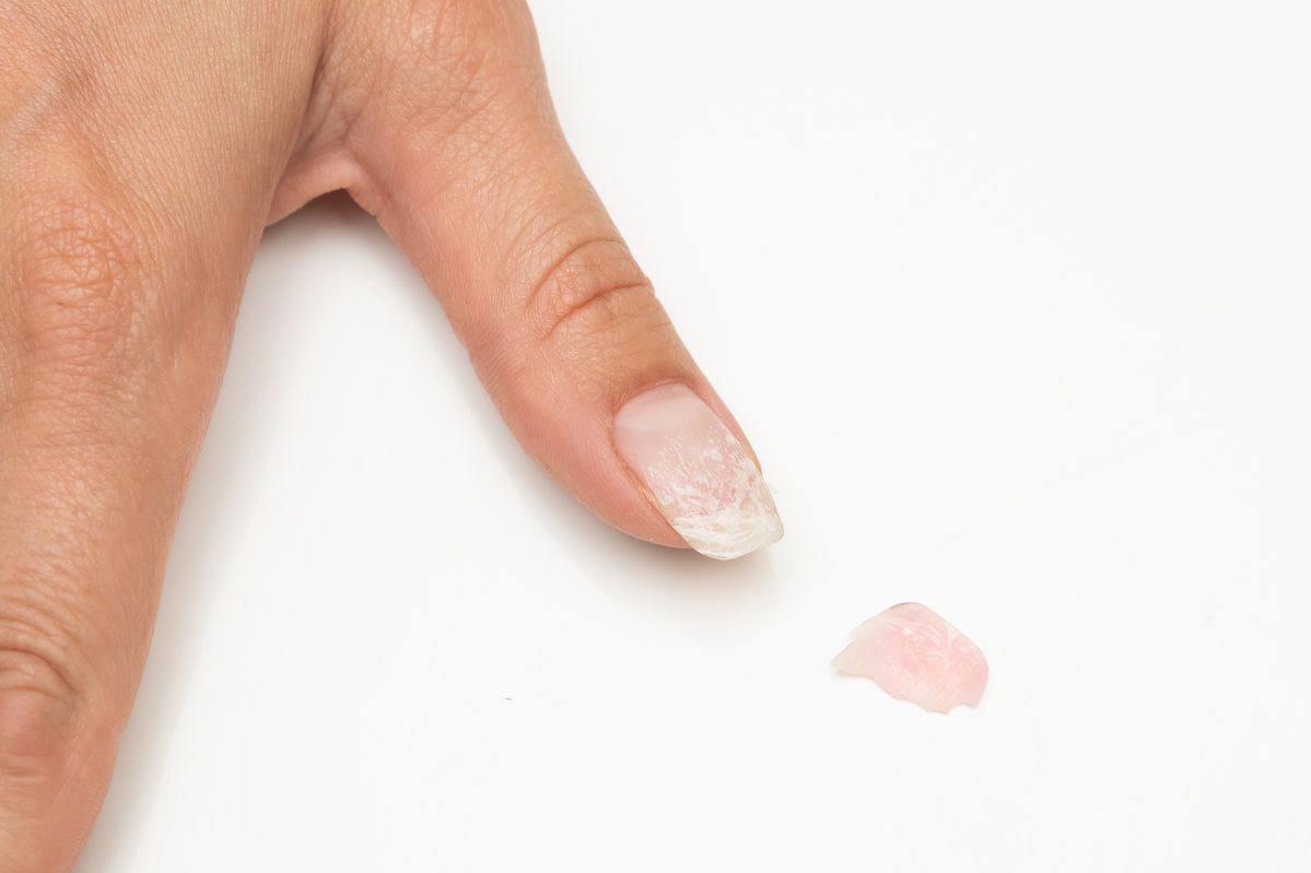  What to do if your gel chips only days after your appointment